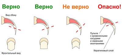 Иллюстрация к комментарию