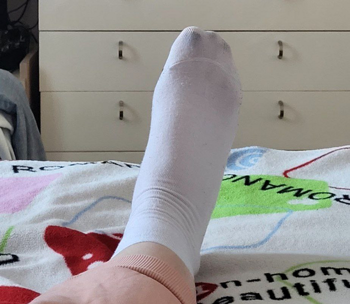 Нога собственной персоной