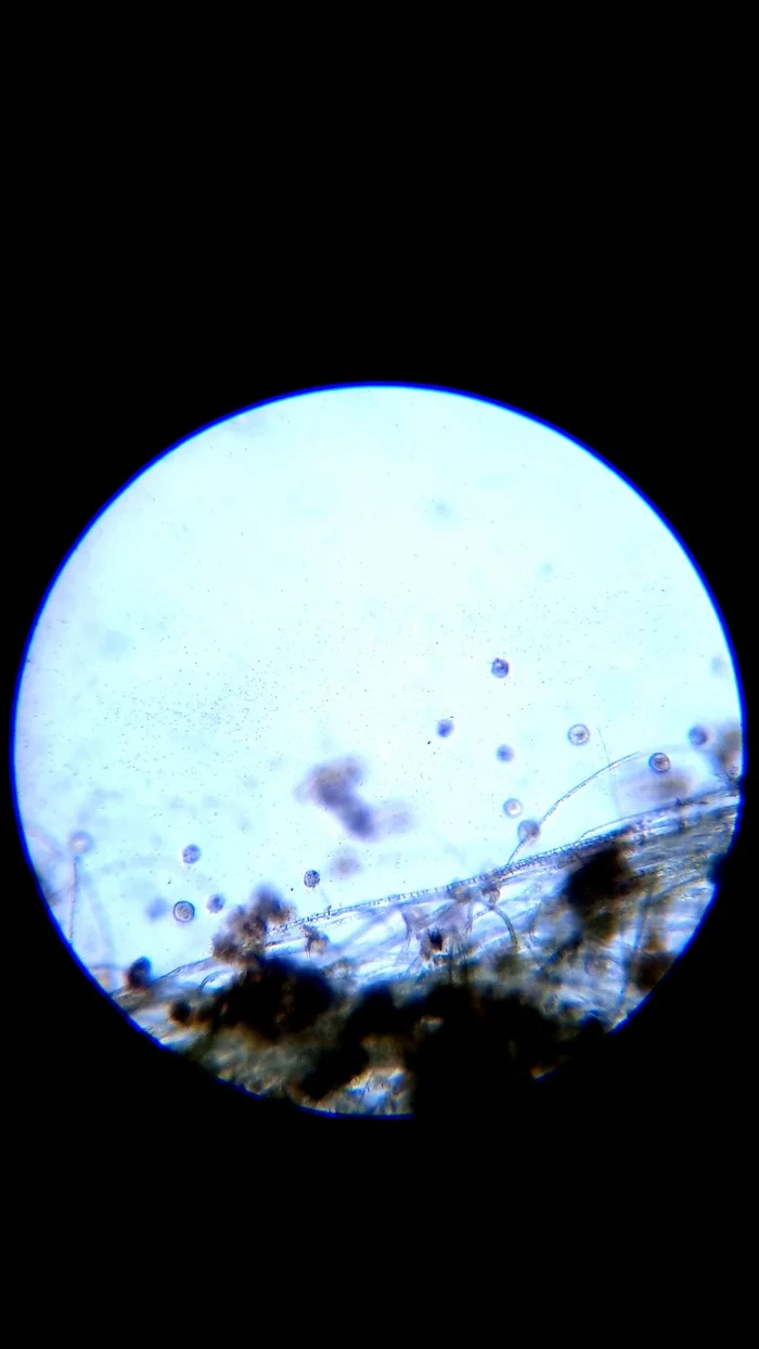 Halteria ciliates in water for irrigation - My, Microscope, Nauchpop, Microscopy, Video, Youtube, Longpost