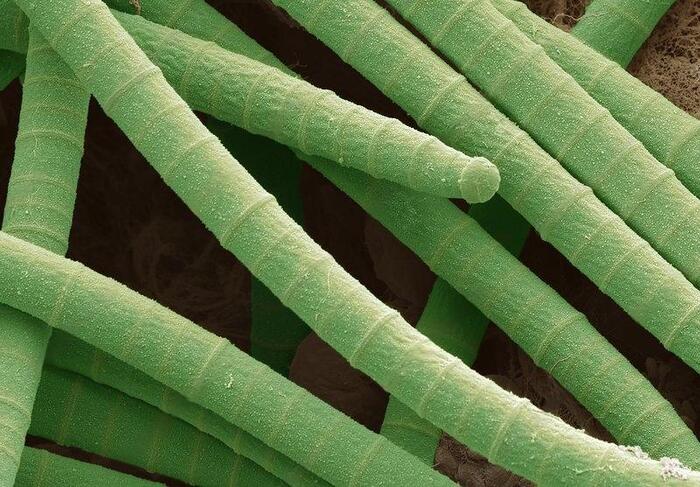 Cyanobacteria under a microscope - My, Biology, Nauchpop, Research, The science, Youtube, Video, Video VK, Longpost