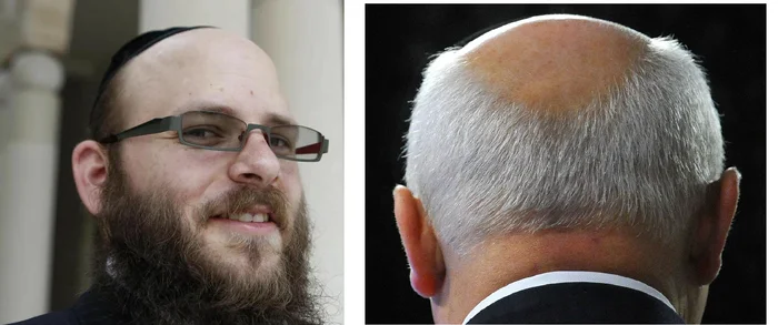 An anecdote about balding Russians and Jews - Joke, Strange humor