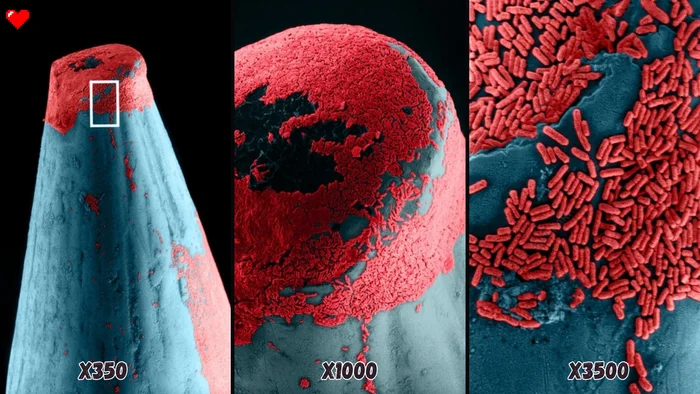 Escherichia coli (E.Coli) bacteria on the surface of a pin - My, Youtube, Biology, The science, Nauchpop, Research, Video, Video VK