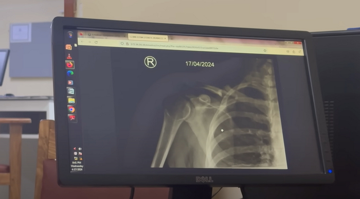   ,     .     -  ,  ,   !              . !  17   .