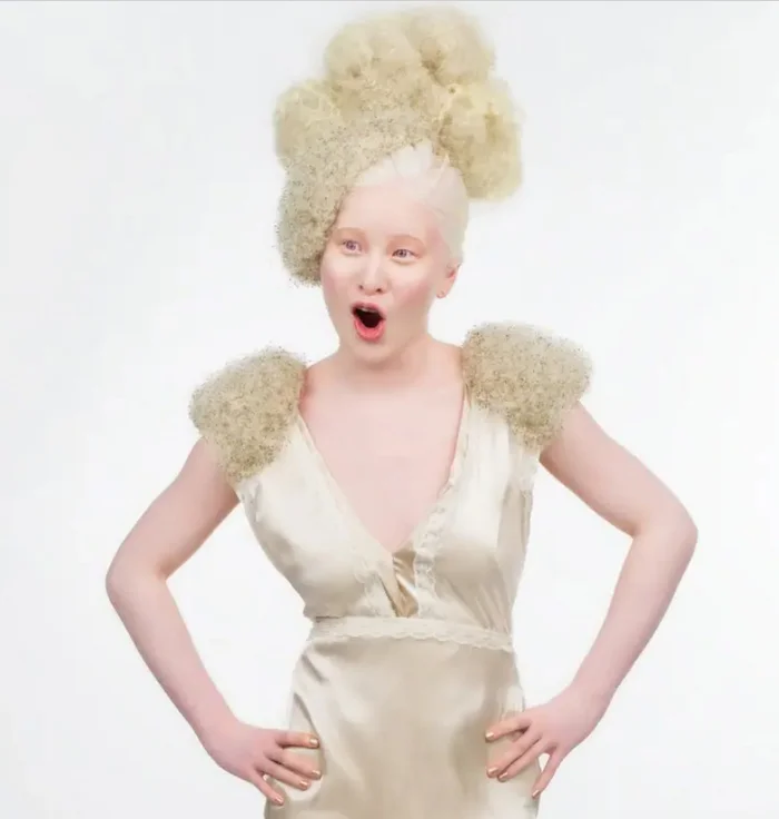 Albino model Xueli: from abandoned child to Vogue icon - My, Personality, Ideal, Perfection, Models, Modeling agency, Supermodel, Success, Wish, Self-development, Albino, Text, Longpost