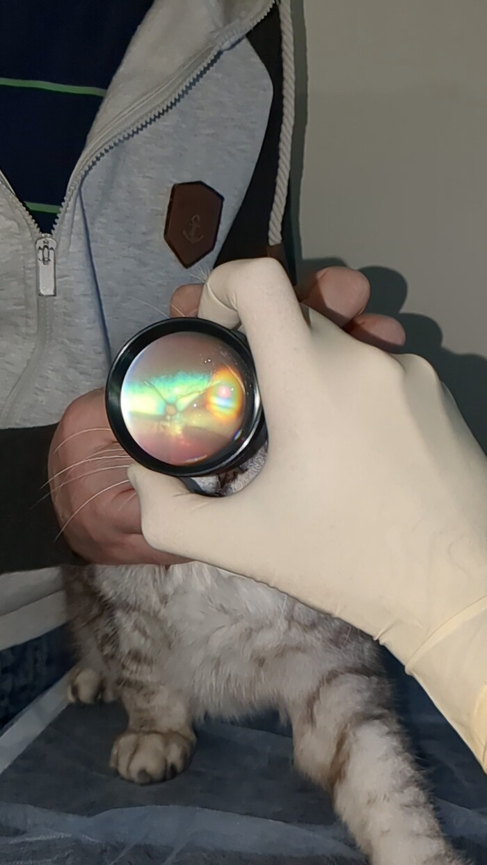 Отслоение сетчатки и кровоизлияния в ней