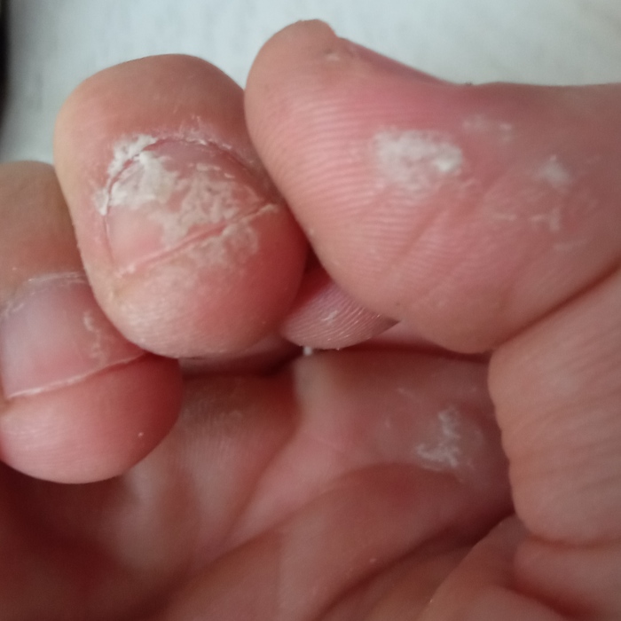 Всё как обычно. В порыве энтузиазма забыл надеть перчатки. Пена полезла с другой стороны, намереваясь упасть на линолеум. Пришлось брать голыми руками.