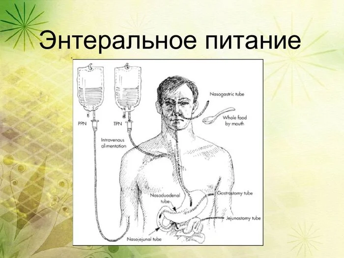 Как обеспечить нужды лежачих больных, которые не могут питаться самостоятельно - Здоровье, ЗОЖ, Медицина, Болезнь, Исследования, Питание, Лежачие, Больные, Еда