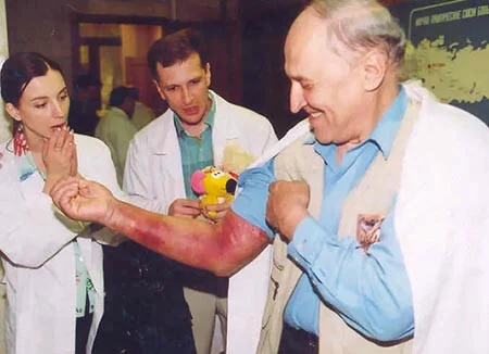 Nikolai Drozdov after being bitten by a marsh viper - Milota, Images, Nikolay Drozdov, Snake bite, Celebrities, Repeat