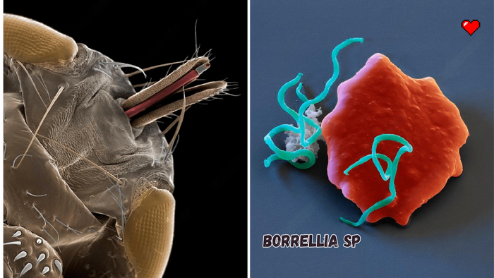        Borrelia (  ).
