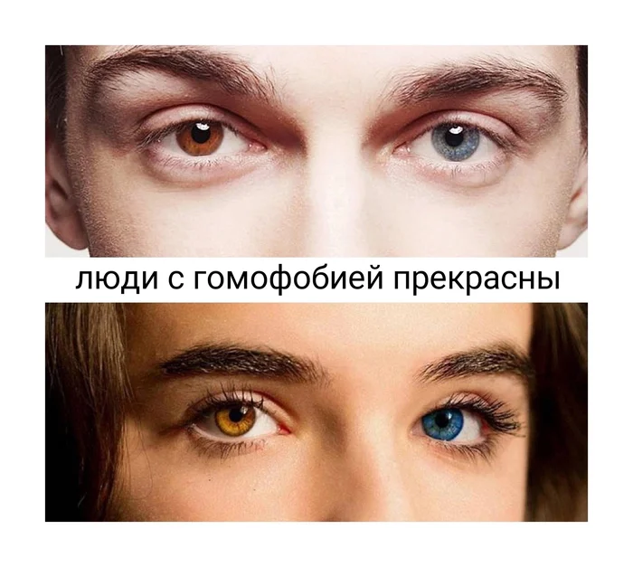 Terminology - Heterochromia, Homophobia, Humor, Eyes