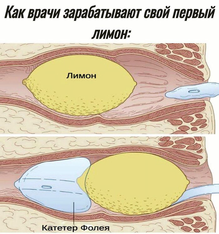 Папилломы на интимных местах