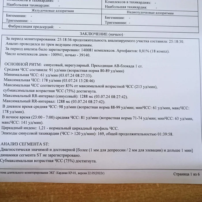 Может кто-то умеет в результатах холтеровского исследования - Моё, Дочь, Без рейтинга, Здоровье, Диагностика, Вопрос, Спроси Пикабу