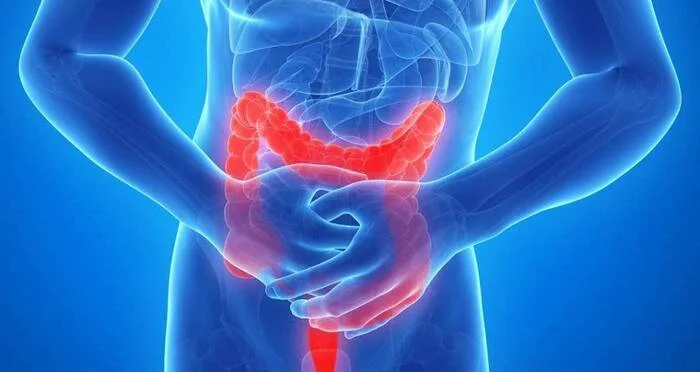 Signs of inflammatory diseases of the colon - Ulcerative colitis, Crohn's disease