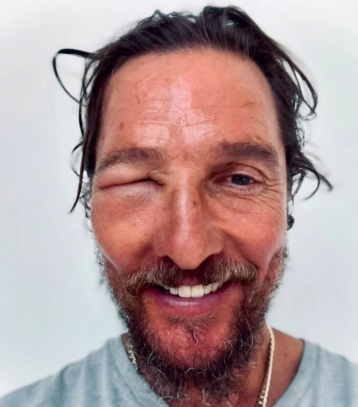 Matthew McConaughey ran into a beehive. Get well soon, old man! - Matthew McConaughey, Face, Bees, The photo