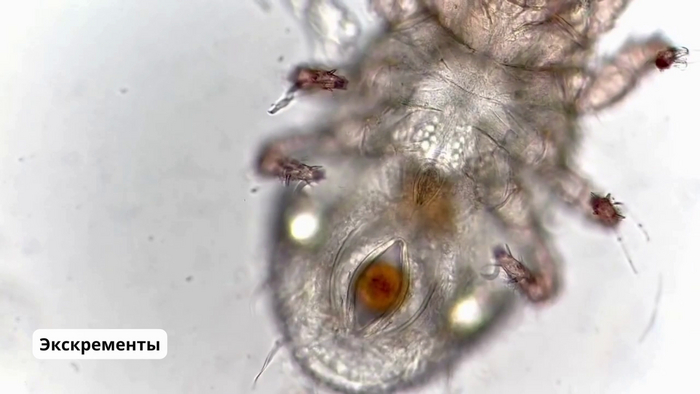 Экскременты пылевого клеща (коричневые). Вызывают аллергические реакции у людей