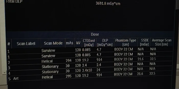 Philips irradiates - Work, Tomography, CT, Philips, X-radiation, Ionizing radiation, Question, Ask Peekaboo, Longpost