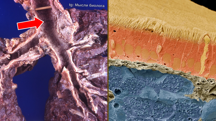 Трахея и микрофотография слизистой оболочки. Электронный микроскоп. Увеличение: x1000