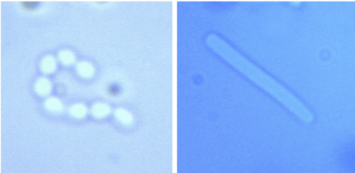 Streptococcus thermophilus (слева) и Lactobacillus bulgaricus (справа)