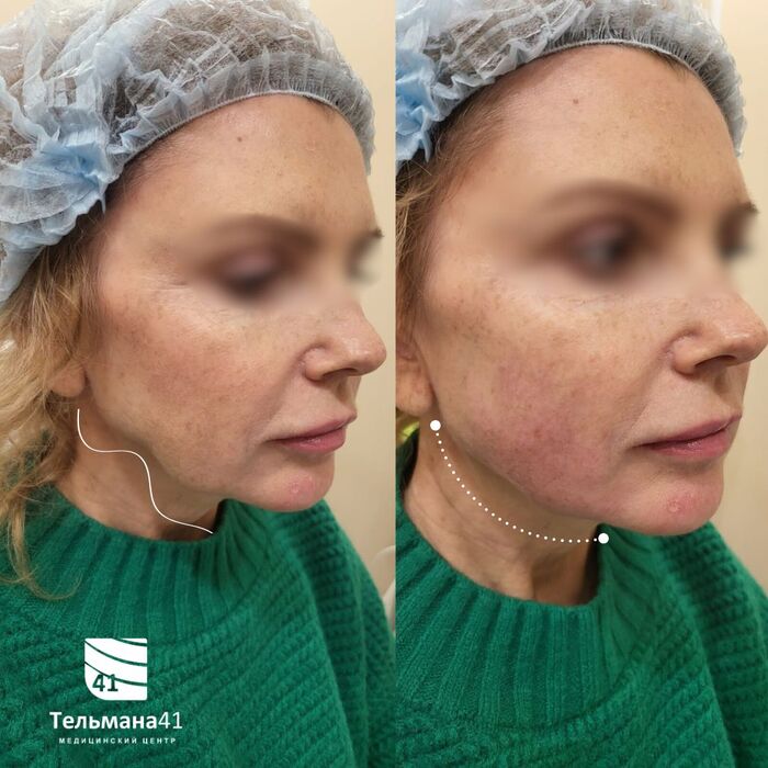 Одно из моих любимых преображений