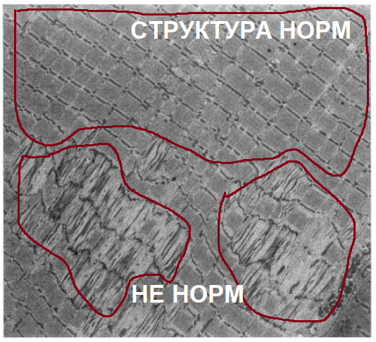 Тренинг внатураху и перетрен - Моё, Тренировка, Фитнес, ЗОЖ, Наука, Спортивные советы, Тренажерный зал, Длиннопост