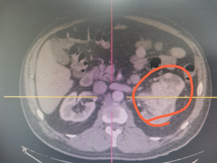 Поперечный срез