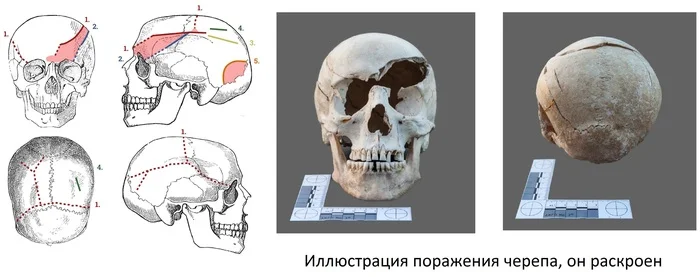 The wrong side of war. Medieval Wounds (Remastered) - My, Military history, Middle Ages, Archeology, Armor, Steel arms, Injury, Post #11637635, Longpost, Series Psychology and the face of war