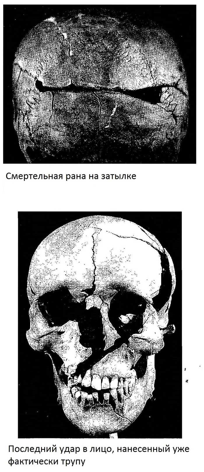 The wrong side of war. Medieval Wounds (Remastered) - My, Military history, Middle Ages, Archeology, Armor, Steel arms, Injury, Post #11637635, Longpost, Series Psychology and the face of war