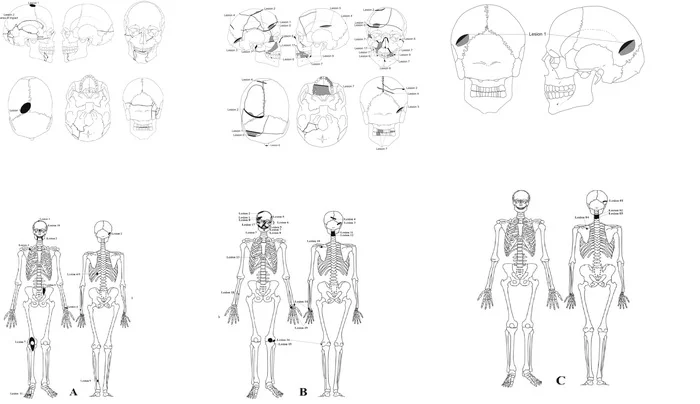 The wrong side of war. Medieval Wounds (Remastered) - My, Military history, Middle Ages, Archeology, Armor, Steel arms, Injury, Post #11637635, Longpost, Series Psychology and the face of war