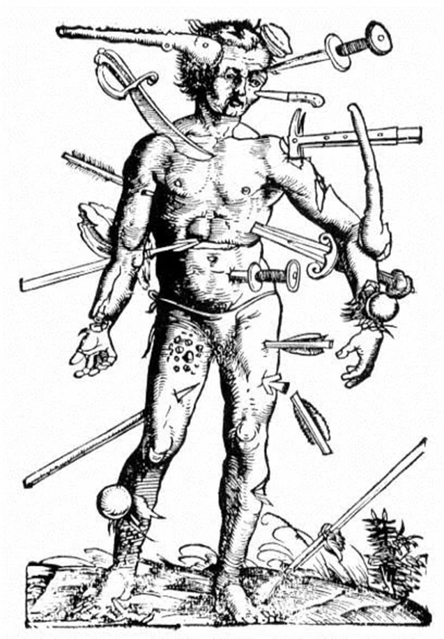 The wrong side of war. Medieval Wounds (Remastered) - My, Military history, Middle Ages, Archeology, Armor, Steel arms, Injury, Post #11637635, Longpost, Series Psychology and the face of war