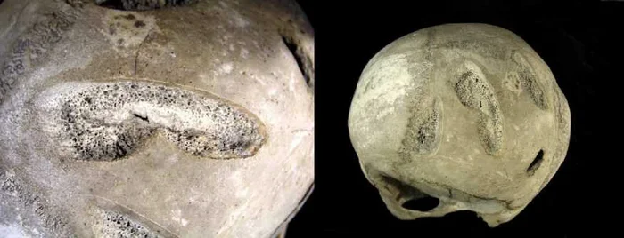 The wrong side of war. Medieval Wounds (Remastered) - My, Military history, Middle Ages, Archeology, Armor, Steel arms, Injury, Post #11637635, Longpost, Series Psychology and the face of war