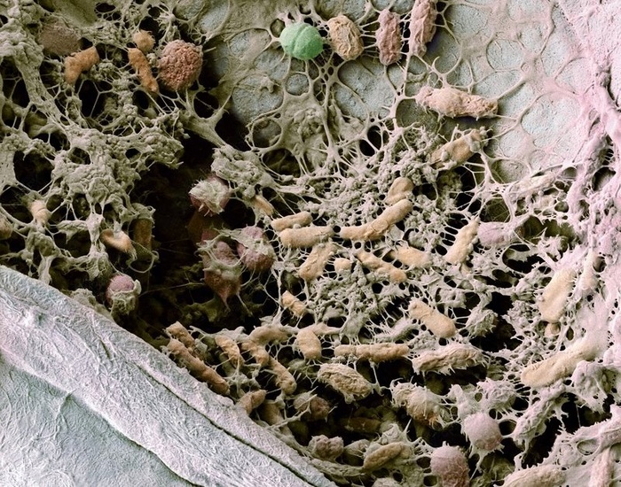 Биоплёнка на поверхности вискозного полотна. Хорошо видно слизь — матрикс, которую бактерии выделяют во внешнюю среду для образования биоплёнки.