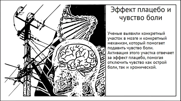 Эффект плацебо и чувство боли. Как мозг перепрошивает себя - Моё, Мозг, Исследования, Наука, Научпоп, Эксперимент, Плацебо, Боль, Длиннопост