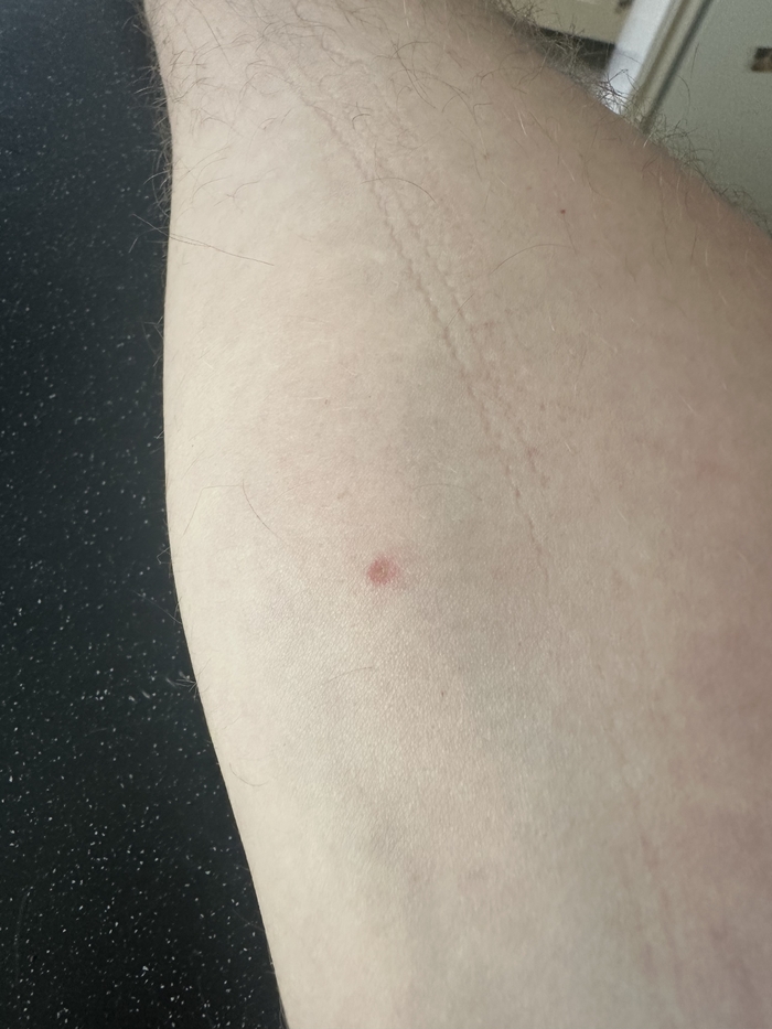 ������-������