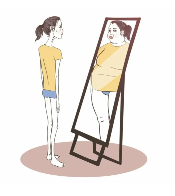 Eating disorder. Research - Eating behavior, Psychology, Proper nutrition, Diet, Slimming, Hunger strike, Mental disorder, Healthy lifestyle, Sport, Psychotherapy