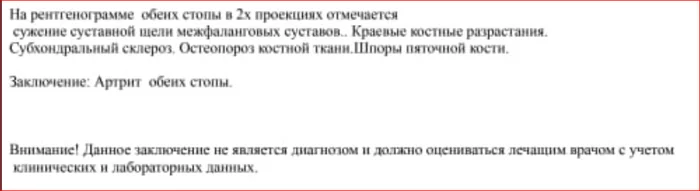 Помогите с лечением сестренки - Моё, Врачи, Операция, Лекарства, Рентген, Травматология, Больница, Артрит, Остеопороз, Суставы, Кости, Диагноз, Вопрос, Спроси Пикабу