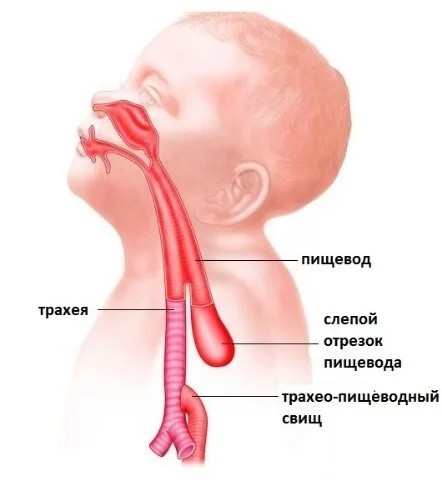 Вредная/полезная для голоса еда - Моё, Питание, Еда, Голос, Вокал, ЗОЖ, Диета, Кофе, Вредные привычки, Правильное питание, Пение, Вокалисты, Видео, Видео вк, Длиннопост