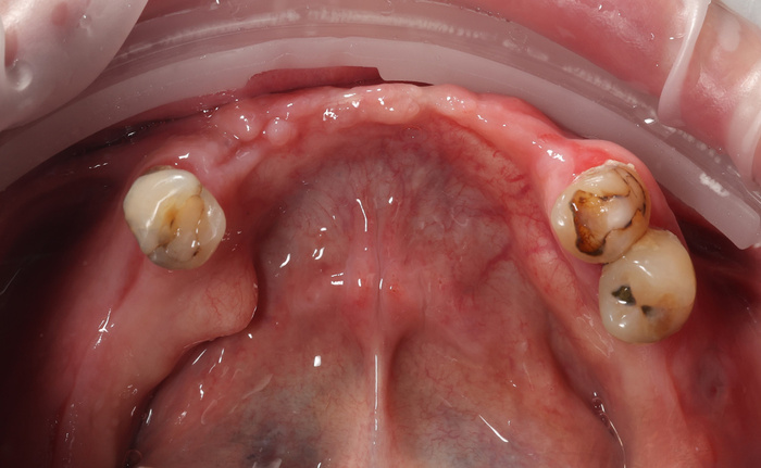 ����������� "�� �� 6" �� ������ �������, Neodent