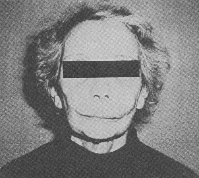      :     .   : J. Dequeker, 1989.