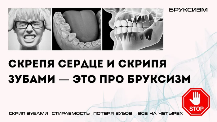 Скрепя сердце и скрипя зубами — это про бруксизм - Стоматология, Медицина, Здоровье, Лечение, Ортодонтия, Зубы, Бруксизм, Видео, Без звука, Telegram (ссылка), Яндекс Дзен (ссылка), Длиннопост