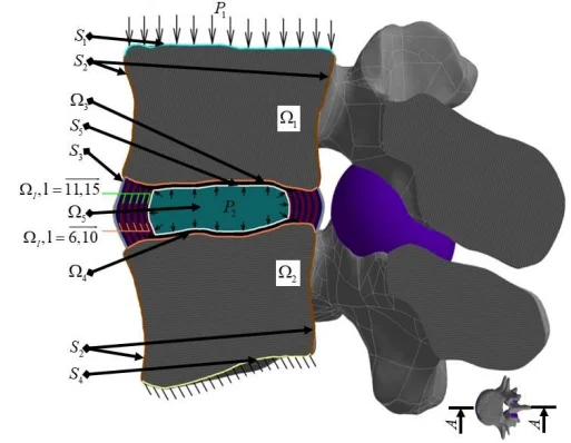 A study by Perm Polytechnic scientists makes it possible to more accurately determine the source of back pain - Pnipu, Spine, Lower back pain, Joints, 3D modeling, Biomechanics, Longpost