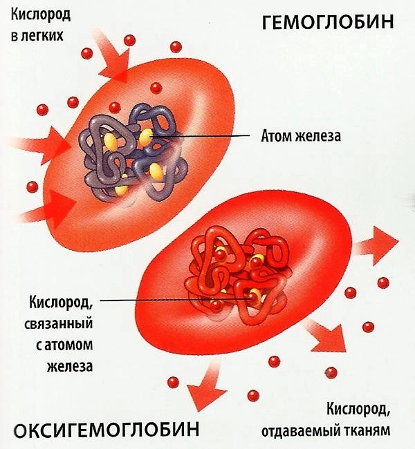 Анемии. О том что бывает чаще - Моё, Анемия, Терапия, Медицина, Длиннопост