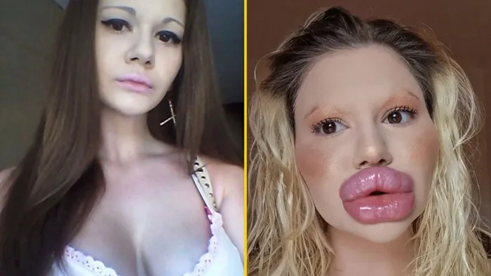 'Bulgarian Barbie' claims she has the biggest lips in the world - Lips, Plastic surgery, Longpost