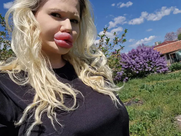 'Bulgarian Barbie' claims she has the biggest lips in the world - Lips, Plastic surgery, Longpost