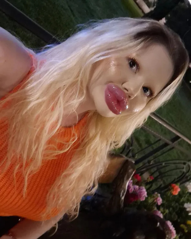 'Bulgarian Barbie' claims she has the biggest lips in the world - Lips, Plastic surgery, Longpost