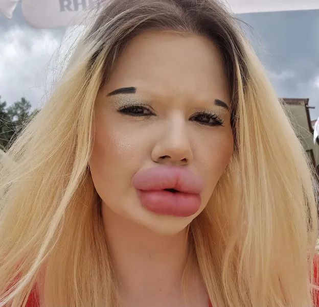 'Bulgarian Barbie' claims she has the biggest lips in the world - Lips, Plastic surgery, Longpost