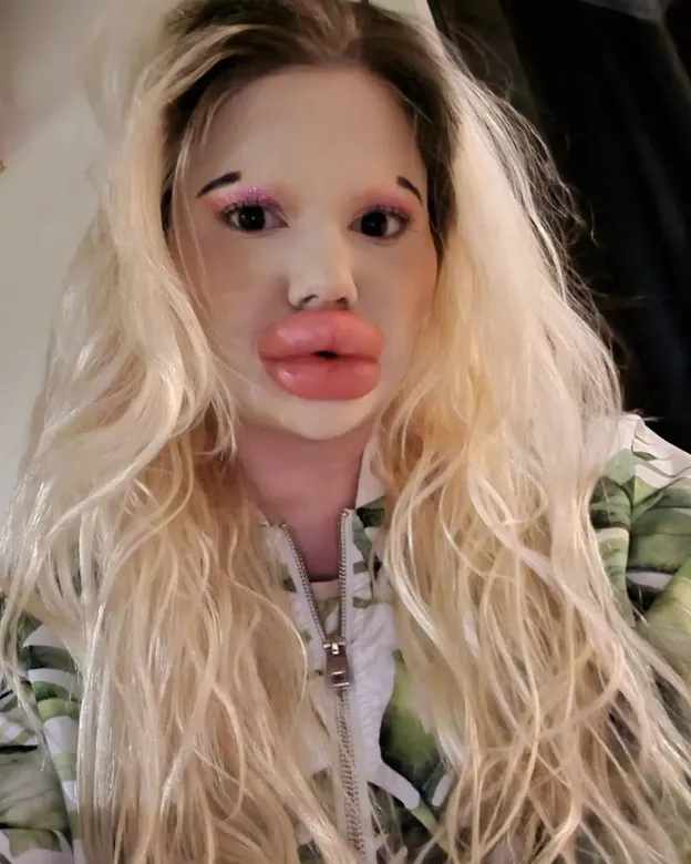 'Bulgarian Barbie' claims she has the biggest lips in the world - Lips, Plastic surgery, Longpost