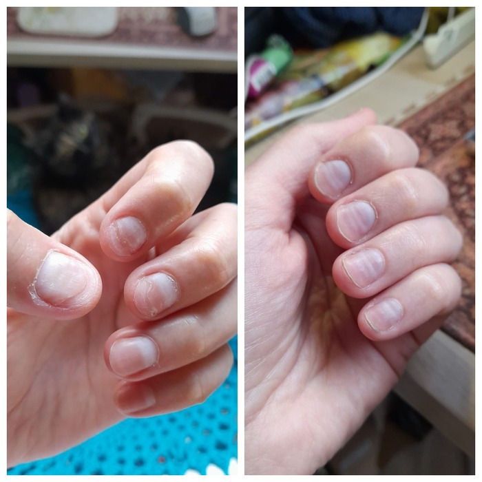 Разница фото в 2 месяца