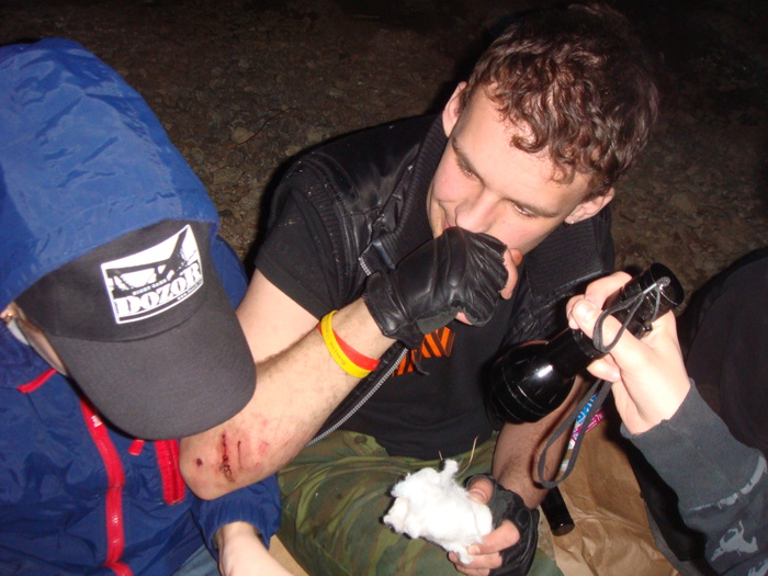 Последствия падения в колодец. Многие играли в дозор и в EN и в СХватку