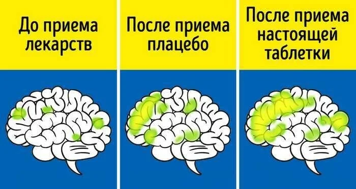 Как работает эффект плацебо - Мозг, Здоровье, ЗОЖ, Исследования, Лекарства, Длиннопост, Плацебо