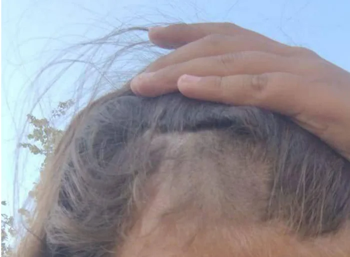 “This is not your land”: in the Moscow region, migrants cut off a girl’s head hair in retaliation for a remark - Negative, Migrants, Attack, Girl, Butovo, Moscow, Beating, Aggression, The photo, Longpost